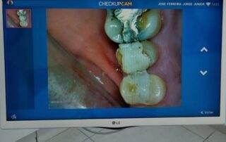 CHECK-UP PREVENTIVO DIGITAL 3 clínica ferreira jorge dentistas e psicólogos em santos