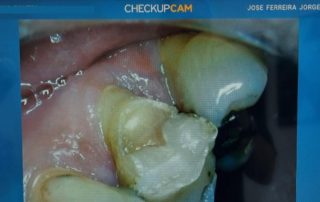 CHECK-UP PREVENTIVO DIGITAL 4 clínica ferreira jorge dentistas e psicólogos em santos