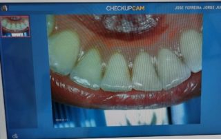 CHECK-UP PREVENTIVO DIGITAL 7 clínica ferreira jorge dentistas e psicólogos em santos