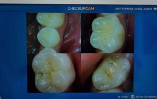 CHECK-UP PREVENTIVO DIGITAL 5 clínica ferreira jorge dentistas e psicólogos em santos