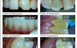 CHECK-UP PREVENTIVO DIGITAL 8 clínica ferreira jorge dentistas e psicólogos em santos