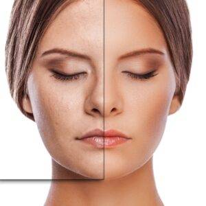 Especialidades-harmonizacao orofacil 6 clínica ferreira jorge dentistas e psicólogos em santos